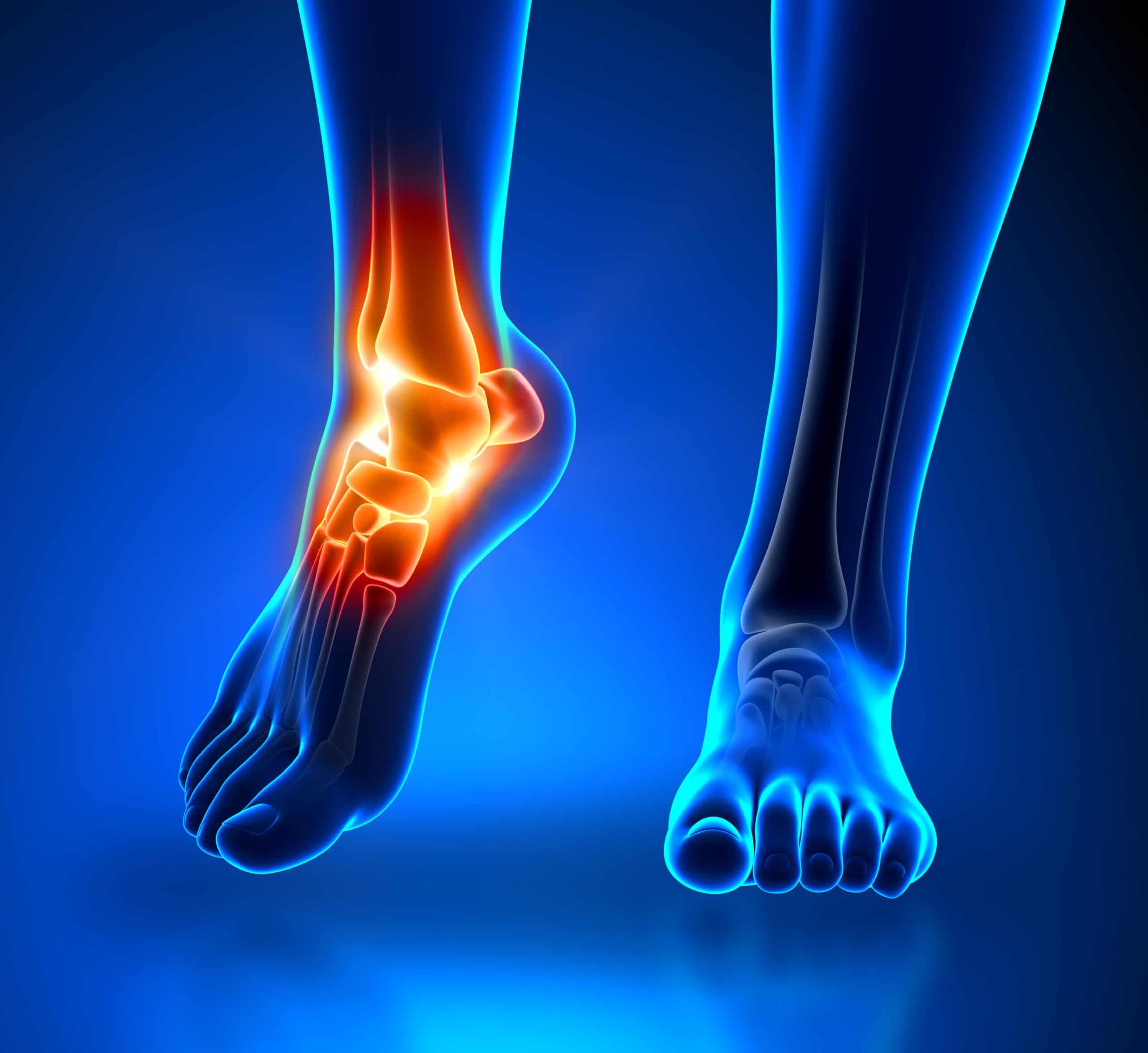 Ankle Pain, Causes & Treatment