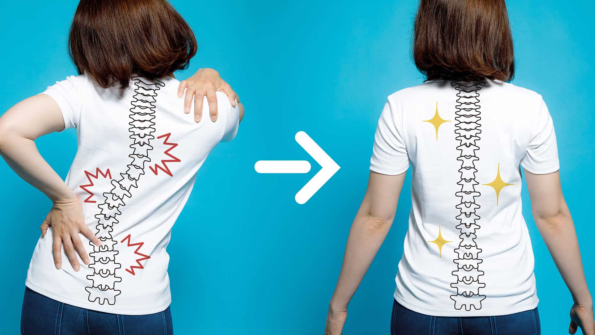 spine-before-after-chiropractic