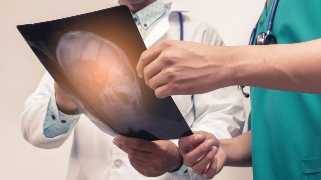 two doctors examining x-ray film of patient after general neurosurgery