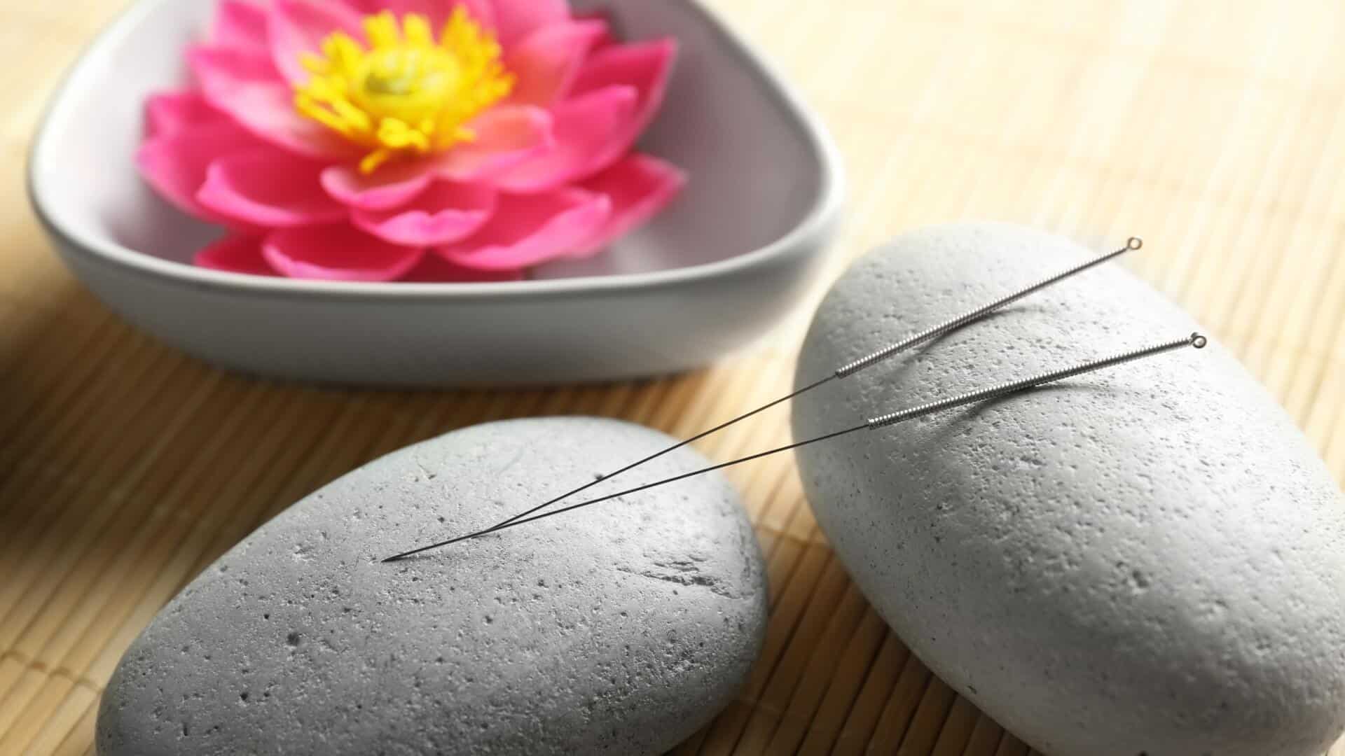 acupuncture needles with stones on bamboo mat