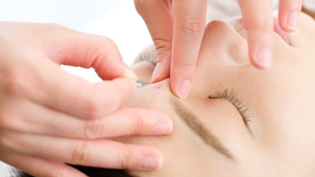 a person gets a needle in their face from acupuncture treatment