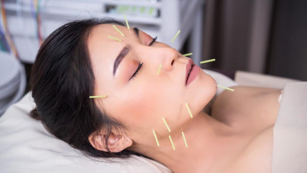 a person closes their eyes and undergoes acupuncture treatment on their face