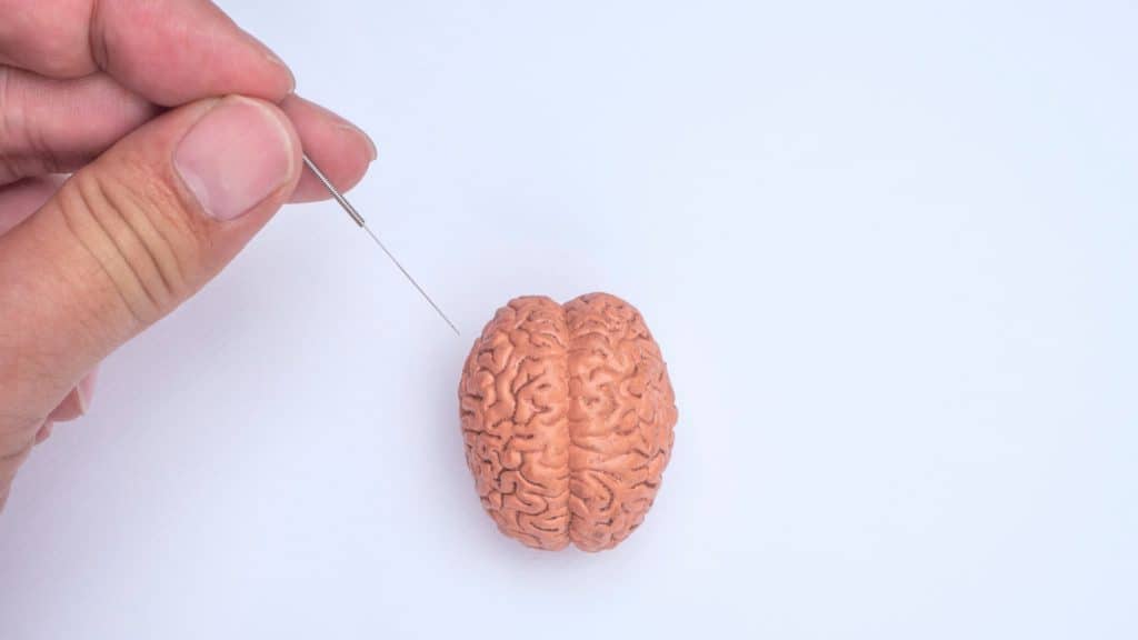 Acupuncture needles poke model of a brain | Acupuncture for Headaches and Migraines | NorthEast Spine and Sports Medicine