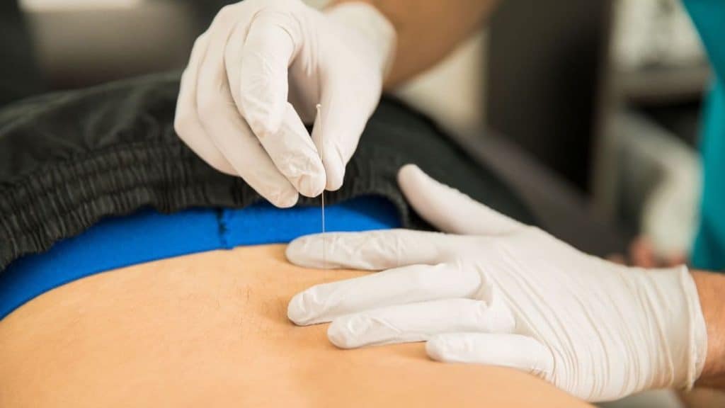 Close up of acupuncturist inserting needle into hip | Acupuncture for Back Pain at Northeast Spine and Sports Medicine