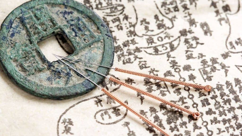 Acupuncture needles rest on top of ancient Chinese coin | Acupuncture for Back Pain at Northeast Spine and Sports Medicine