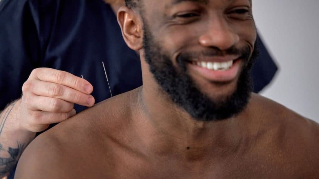 Close up of man smiling while acupuncture needle is inserted into his back | Northeast Spine and Sports Medicine